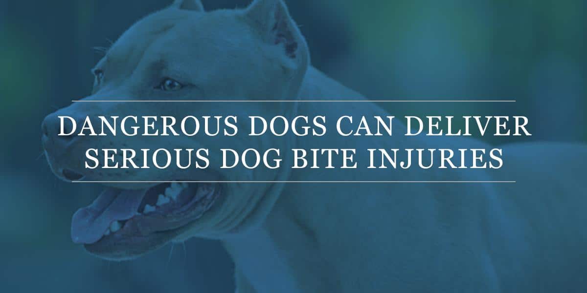 Dangerous Dogs Can Deliver Serious Dog Bite Injuries